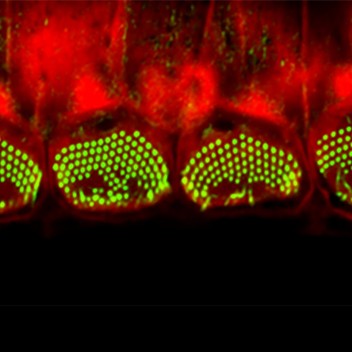 Super-resolution image of P7 wild type mouse maturing vestibular hair cells showing the immunolocalization in red of Plasma Membrane Calcium-ATPase-2 (PMCA2) essential for hair bundle Ca2+ homeostasis. Actin in cyan.