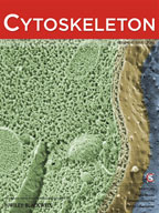Cytoskeleton publication cover Jan 2010