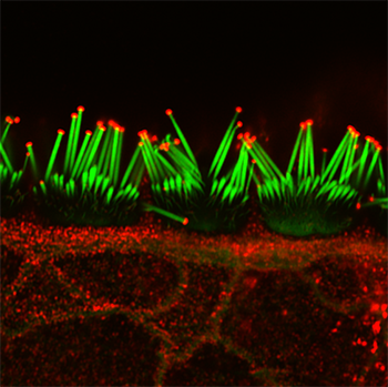 P15 mouse inner hair cells of the organ of Corti used for immunofluorescent detection of actin filaments (shown in green, Phaloidin-488) and Eps8 (shown in red) by confocal microscopy superresolution imaging.