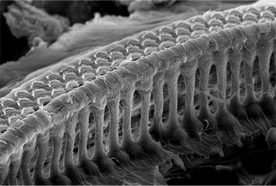 An electron microscope image of the inner ear showing rows of sensory hair cells.