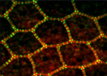 Fluorescent probes attached to proteins in the epithelial belt show the precisely structured network connecting individual epithelial cells. (Image courtesy of NIDCD Laboratory of Cell Structure and Dynamics)