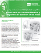 Acueductos vestibulares dilatados y la pérdida de audición en los niños (Enlarged Vestibular Aqueducts and Childhood Hearing Loss)