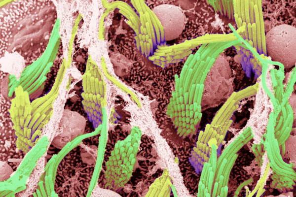 Utricular hair cell bundles taken from a scanning electron microscope. Source: Mhamed Grati.