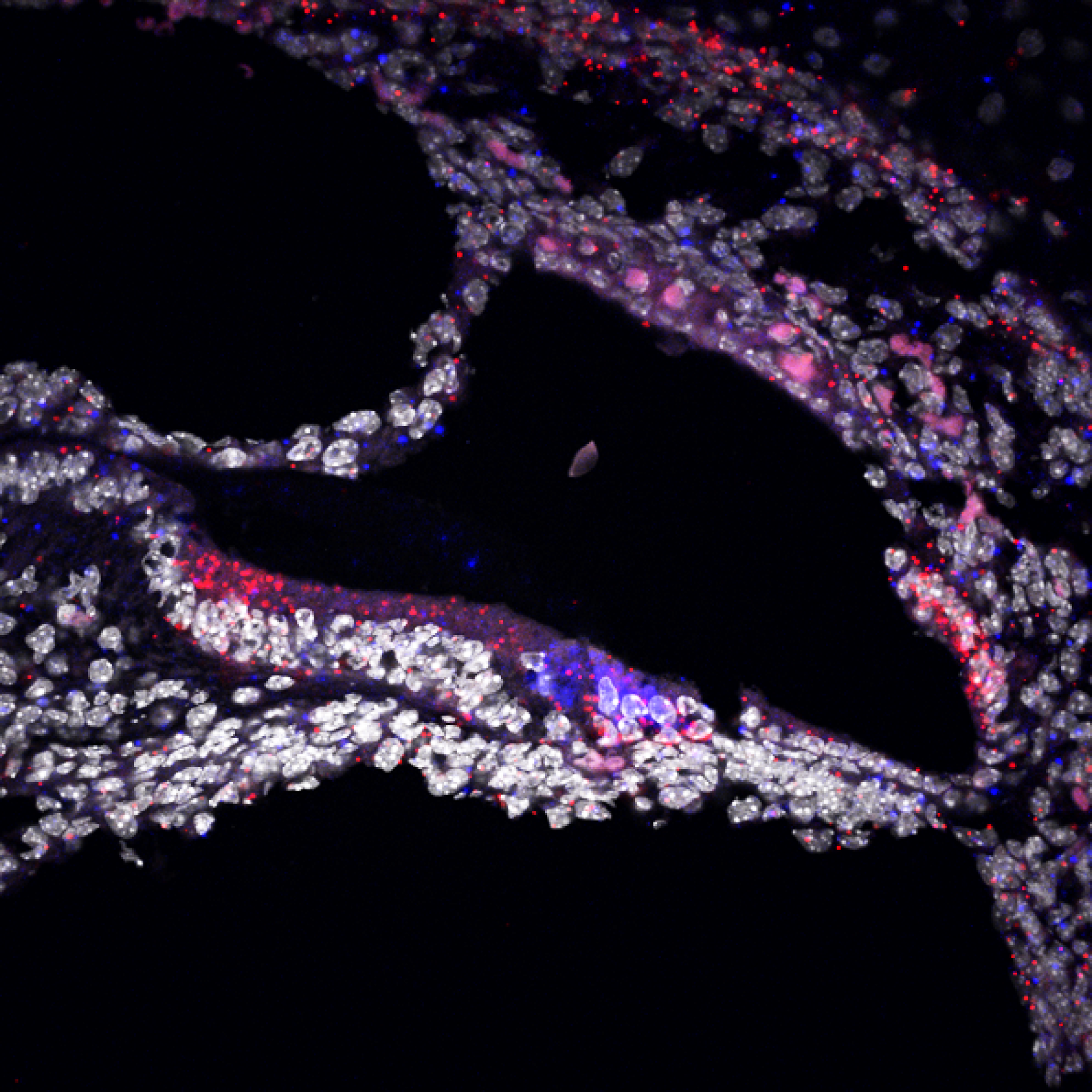 Confocal image of a row of sensory inner hair cells in red (TRIOBP-5 in green) from a shaker-2 mutant mouse.