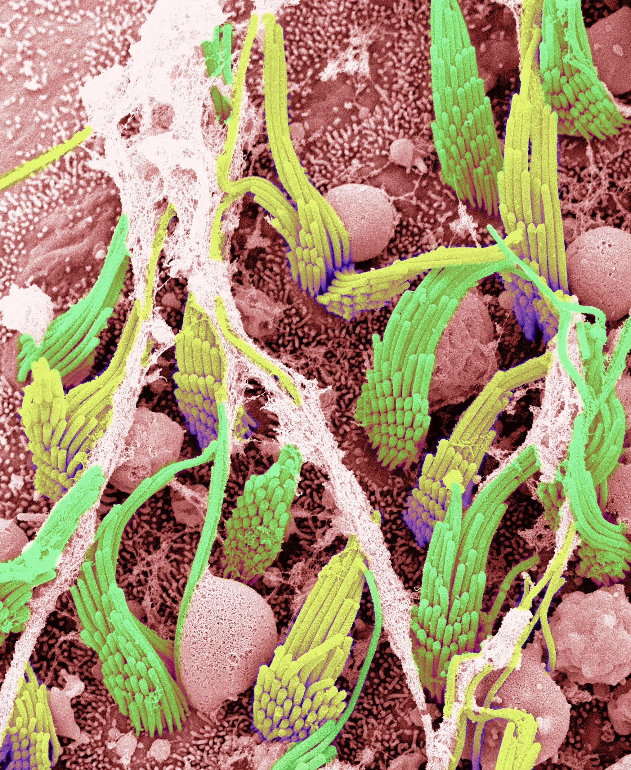 utricular hair cell bundles taken from a scanning electron microscope