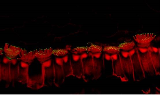 Enhanced microscopic image showing hair-like projections (stereocilia) on the sensory hair cells in the inner ear of a mouse model treated with inner ear gene therapy. The mouse has a genetic form of deafness that causes the stereocilia to be short and defective. Gene therapy elongated the stereocilia and improved hearing.