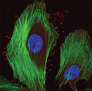 Image of HeLa cells  expressing mCherry-myosin 15 (red) and stained with phalloidin (green) to  reveal filamentous actin and Hoechst stain (blue) to label nuclei.