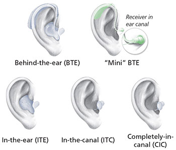 5 types d'aides auditives.  Contour d'oreille (BTE), Mini BTE, In-the-ear (ITE), In-the-canal (ITC) et Completely-in-canal (CIC)