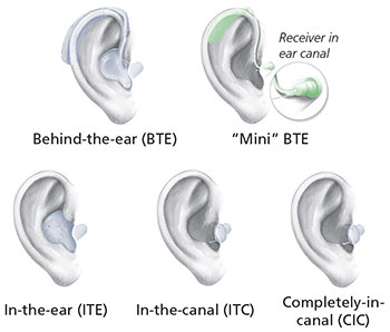 5 types of hearing aids. Behind-the-ear (BTE), mini-BTE, in-the-ear (ITC), in-canal (ITC) and full-in-canal (CIC)