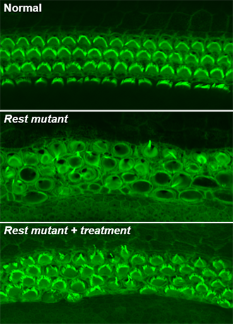 Top: healthy hair cells is depicted by rows of green arcs. Middle: Jumbled cells with no visible green arcs. Bottom: Rest mutant plus treatment—green arcs visible, but less organized that in non-mutated.