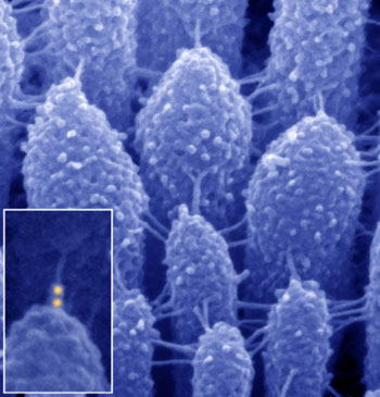 Scanning electron microscopy image illustrates tiny extracellular links between stereocilia of an inner ear hair cell. One type of link, the tip link, connects the top of the shorter stereocilium to the side of a longer stereocilium and is crucial for hearing. The yellow dots in the inset are the immuno-gold particles that label specific proteins comprising the tip link. (Credit: G. Frolenkov, Ph.D.)