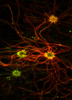 Olfactory sensory neurons express green  and red fluorescently tagged proteins after being infected   by a common cold virus.