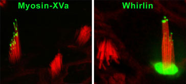 Restoration of the elongation and staircase organization of abnormally short hair cell stereocilia bundles in myosin XVa mutant mice (shaker 2) and whirlin mutant mice after gene gun mediated transfection of wild-type GFP-myosin XVa and GFP-whirlin, respectively (Belyantseva et al., 2005).