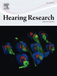 hearing research publication cover August 2014