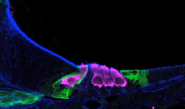 Enhanced microscopic image showing sensory hair cells (colored pink) developing in a newborn mouse cochlea.