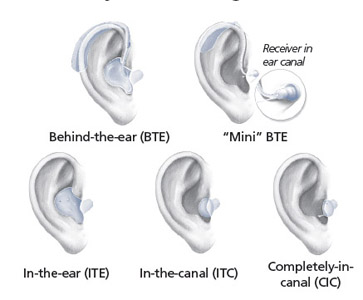 5 types of hearing aids. Behind-the-ear (BTE), Mini BTE, In-the-ear (ITE), In-the-canal (ITC) and Completely-in-canal (CIC)
