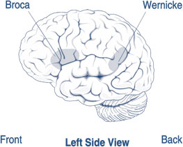 What Is Aphasia? — Types, Causes and Treatment