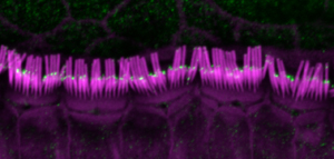 The larger form of myosin 15 is found inthe shorter rows of mouse hair cell stereocilia.