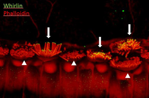 Gene therapy restores whirlin expression in whirler inner hair cells.