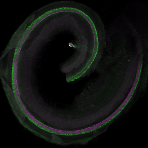 Coiled sensory epithelium of the cochlea with cells labeled in green and magenta on a black background. 