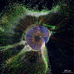 A newborn mouse cochlea (purple) grown in cell culture, and neurons (orange) that send information from the cochlea to the brain.