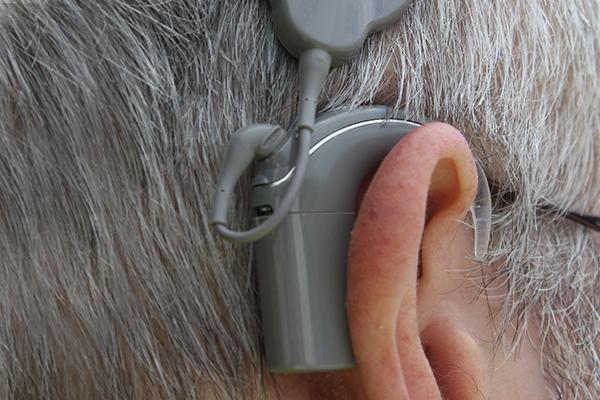 Side profile of middle-aged male with cochlear implant.