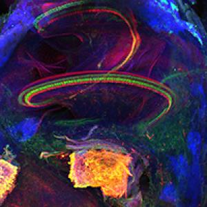 Scientific image showing sensory hair cells (green), nerve fibers (red) & spiral ganglion cells (yellow).