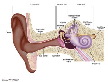 A cross-section of the ear showing the location of the temporal bone, ear canal, and pinna in the outer ear, the eardrum, malleus, stapes, and incus in the middle ear, and the cochlea, eustachian tube, semicircular canals, vestibular nerve, and auditory nerve in the inner ear. Source: NIH/NIDCD.